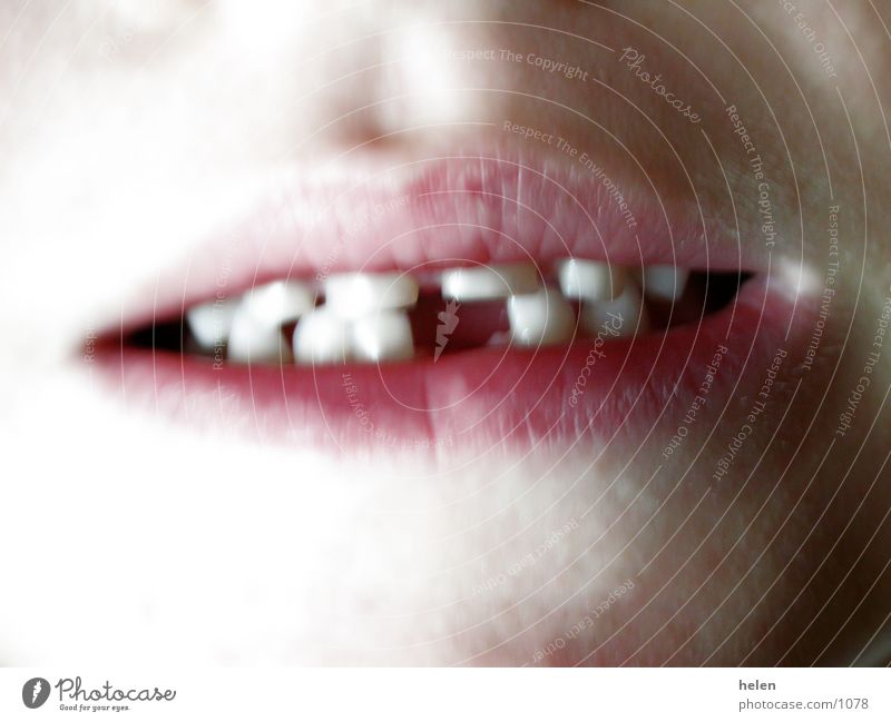 milky_tooth_01 Milk teeth Human being Mouth Teeth