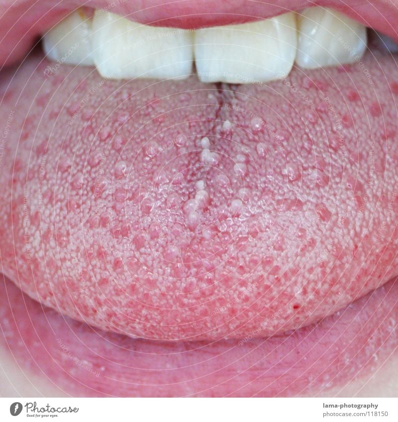 Doktorspielchen for Beard Hater Lips Pink Red Facial hair Sense of taste Nutrition Senses Mucous membrane Dry Damp Wet Mucus To talk Bacterium Dentist