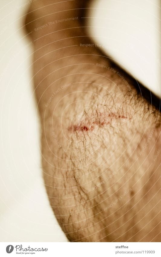 Ouch! Wound Scratch mark Abrasion Man Human being Legs prospecting Scrape Men's leg Detail Section of image Healing Hair