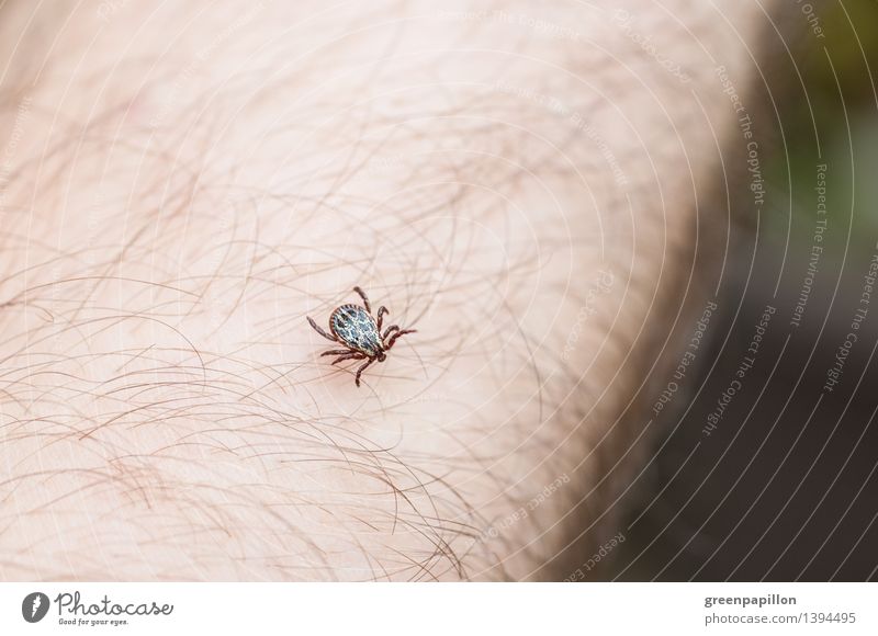 tick on the skin Tick Parasite Bloodsucker Lyme disease TBE Insect Skin pathogens Risk of infection peril Carrier Bite Mites Nature Summer Forest tick bite