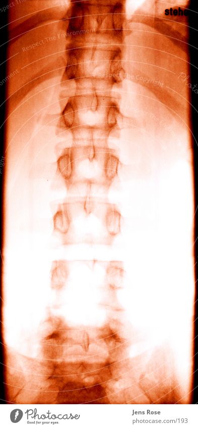 x-ray01 Skeleton Radiation Human being Back Radiology