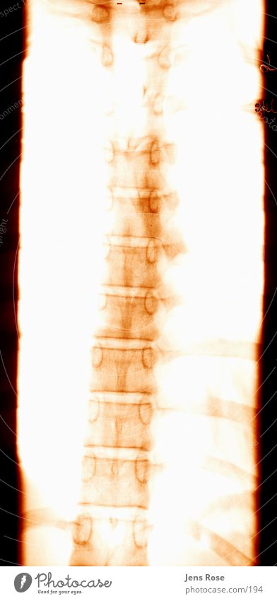 x-ray02 Skeleton Radiation Human being Back Radiology