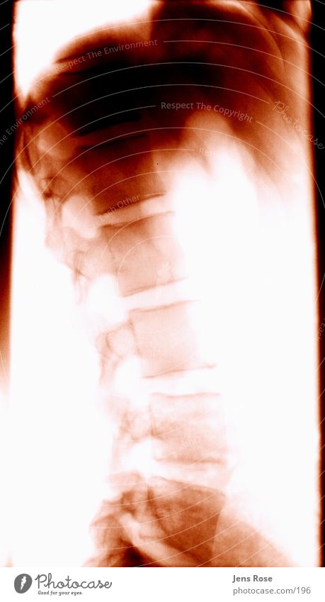 x-ray04 Skeleton Radiation Human being Back Radiology