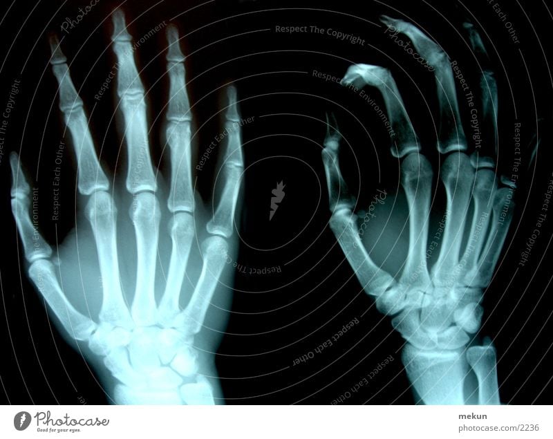 XRay X-rays Hand Doctor Skeleton Health care Photographic technology Radiology