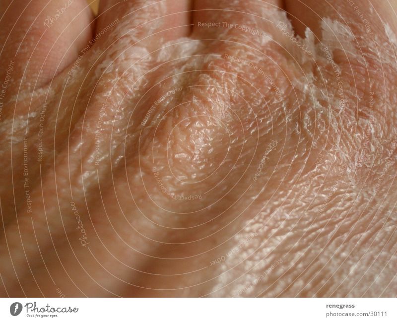 Adhesive on the skin 1 Hand Molt Man Skin