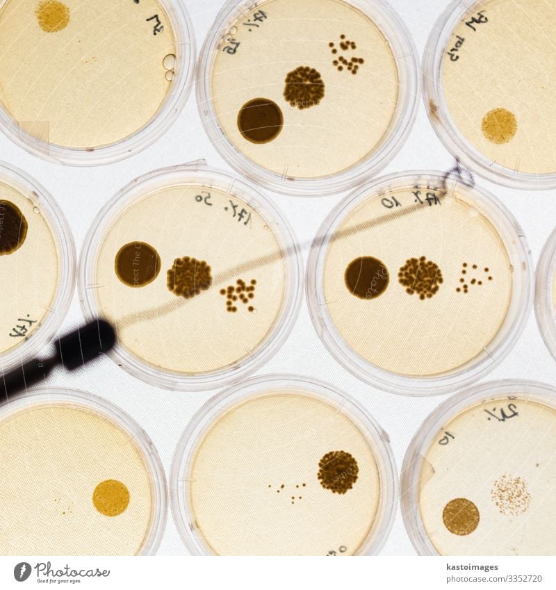 Growing Bacteria in Petri Dishes. Plate Health care Medication Science & Research Laboratory Technology Culture Cleaning Growth Effort scientific bio