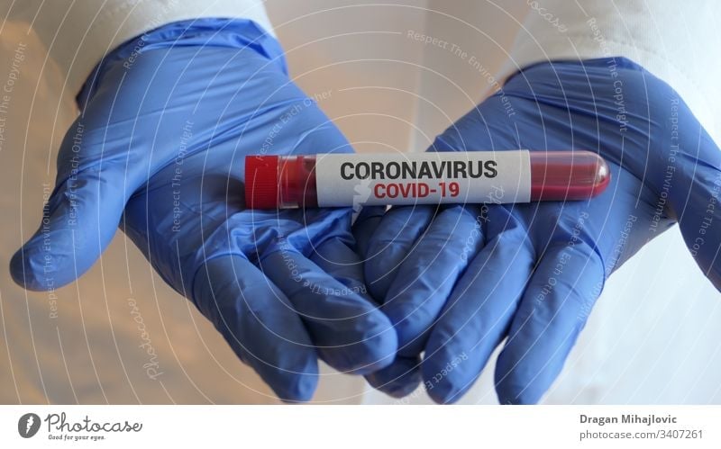 Testing blood for Corona virus 2019-ncov analysis analyzing biohazard biology blood test blood tube care china clinical corona virus coronavirus