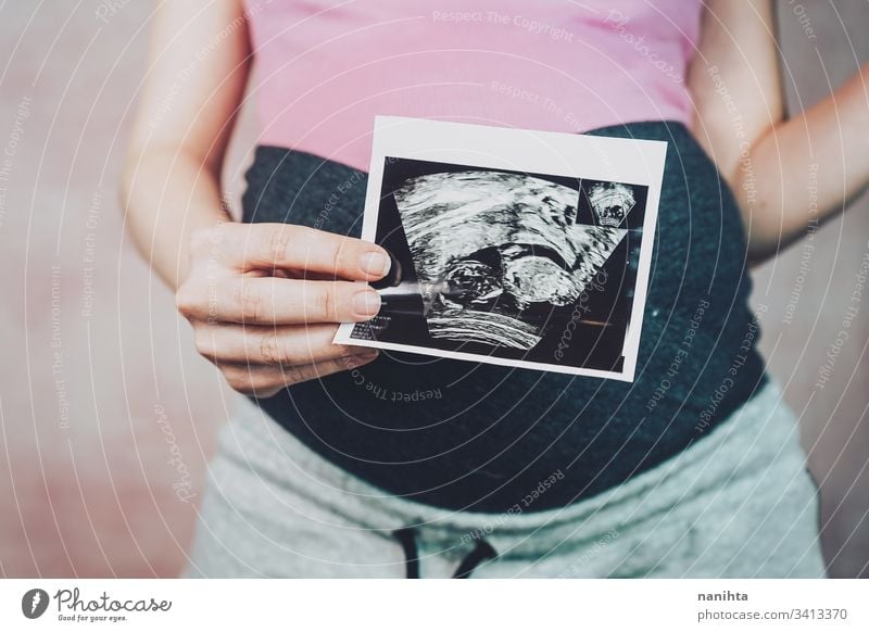 Woman holding the ultrasound of her baby pregnant pregnancy mom family second quarter trimester month 20 weeks health medical treatment equipment shot close