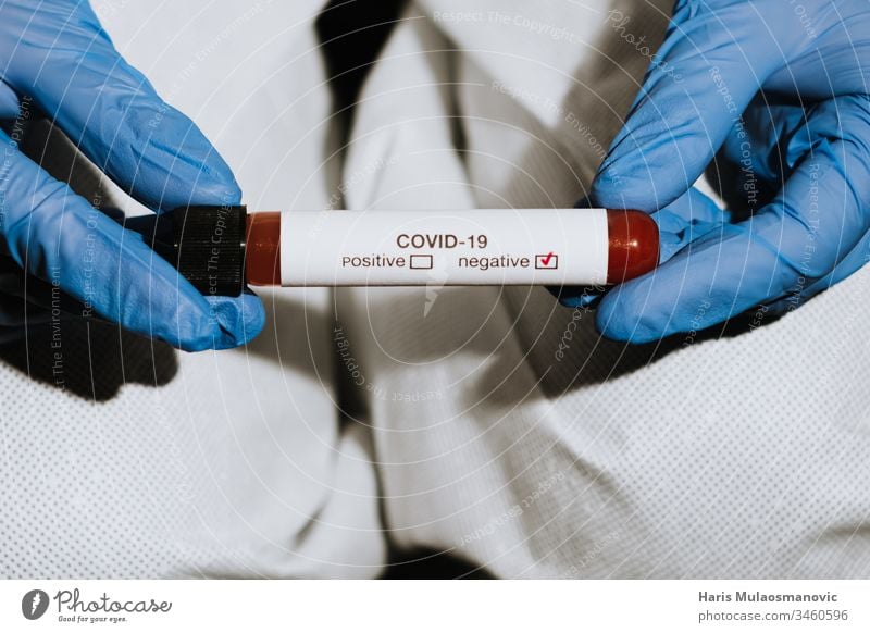 Close up on test tube with blood in hand of doctor showing negative test to coronavirus covid-19 blood sample clinic corona epidemic corona italy corona virus