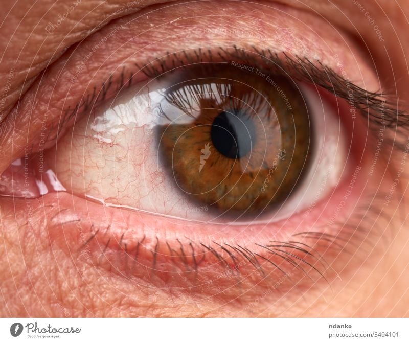 open eye of a man with red vessels, allergic reaction of the body infected close illness vision infection sick injury macro disease allergy blood closeup person