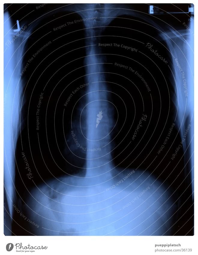 interior shot Lung X-ray photograph Spinal column Thorax Black Man Blue Interior shot Radiology