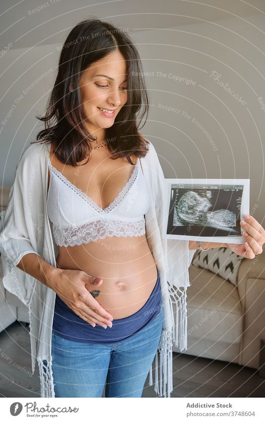 Happy pregnant woman showing an ultrasound scan embrace stomach tenderness motherhood parenthood birth cheerful bonding smile examination newborn planning touch