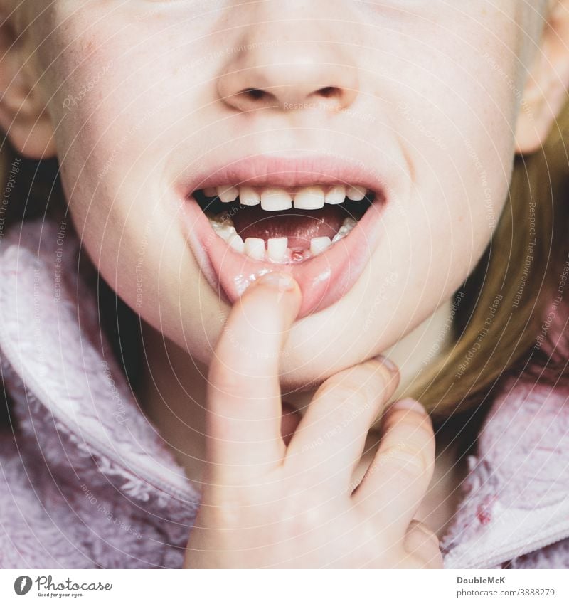 Girl shows gap in her teeth because she has lost her first baby tooth Tooth space Milk teeth Child Infancy Teeth Mouth Colour photo Lips 3 - 8 years Head Face