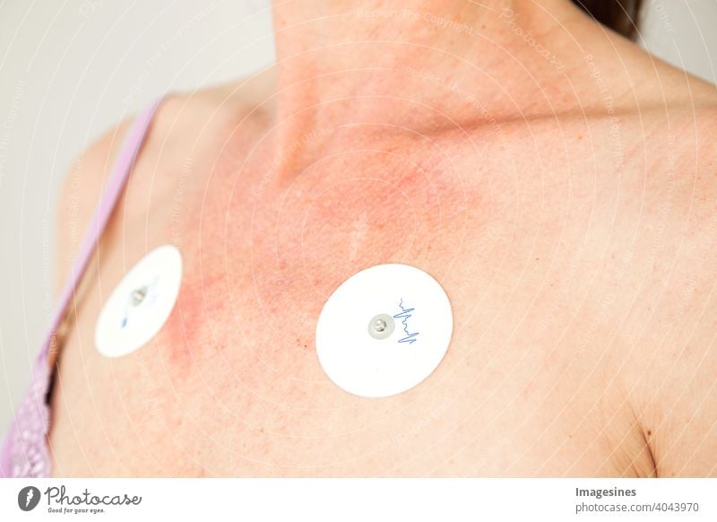 Forgotten ECG electrodes on a woman's breast after treatment. Side view Forget ekg Electrodes Woman Women's BreastBreast Medical treatment side view Stimulation