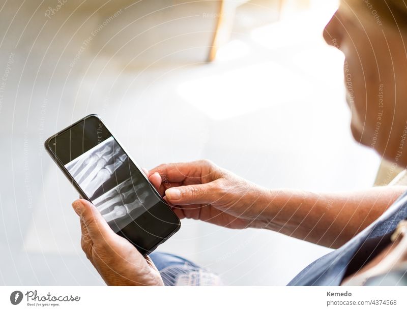 Old Woman watching her x-ray on mobile phone at home, online doctor concept. Copy space top. medical old elder aged medicine remote copy space technology device