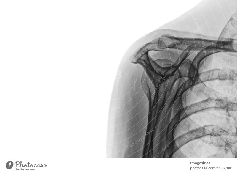 X-ray image of female healthy body. X-ray of female shoulder isolated on white background. Adults Anatomy arm Biceps Biology Biomedicine Bone Chest - Torso
