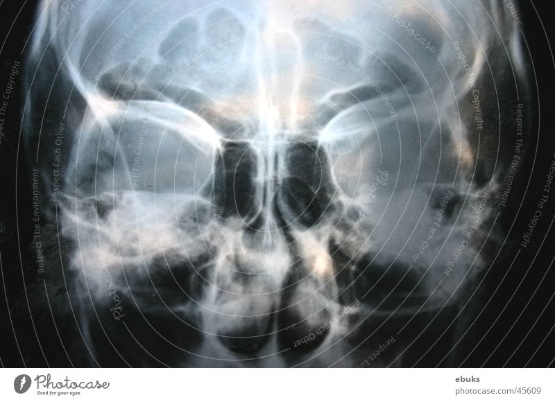 Roentgen head 2 Black White Photographic technology Head Death's head Radiology