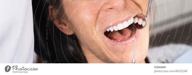 Teeth health concept. Cropped photo of smiling woman mouth under treatment at dental clinic, banner size dentist dentistry care smile white teeth doctor patient