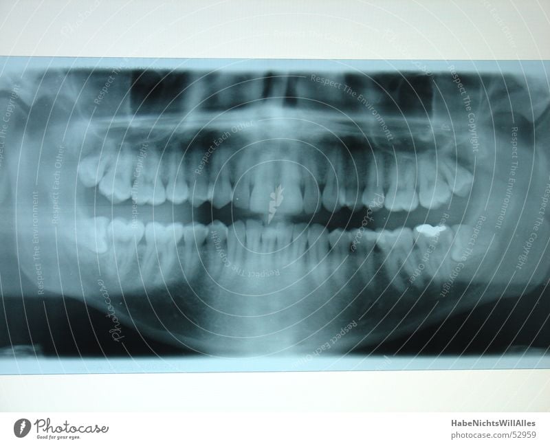 Slate pine? Skeleton Lightbox Amalgam X-rays Blue Root Pine row of teeth lead seal Oral cavity Teeth Radiology