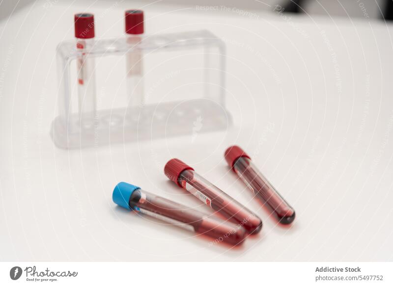 Set of blood samples in tubes on table test tube laboratory biochemistry diagnostic vial diagnosis sterile scientific analysis expertise research science supply