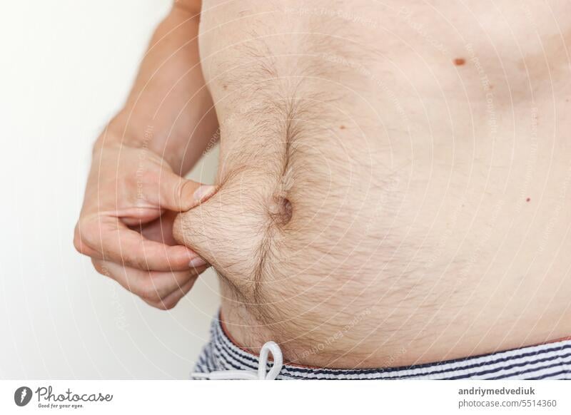 Cropped photo of man is touching his naked not fit belly waistline with loose skin suffering from extra weight. Concept of unhealthy eating and lifestyle, health problems of obese people.