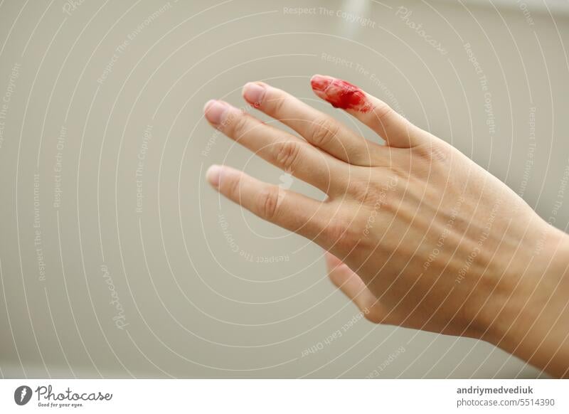 A Damaged And Cut Finger On The Hand A Woman Sticks A Medical