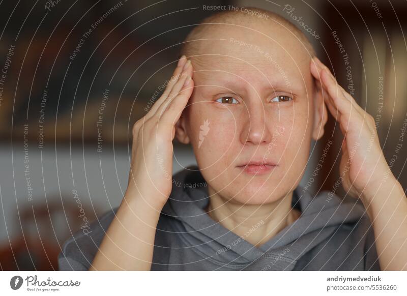 Bald woman touching head with fingers, suffering from headache after chemotherapy. Unhappy hairless cancer sick female having migraine at home. Oncology concept. Healthcare,medicine