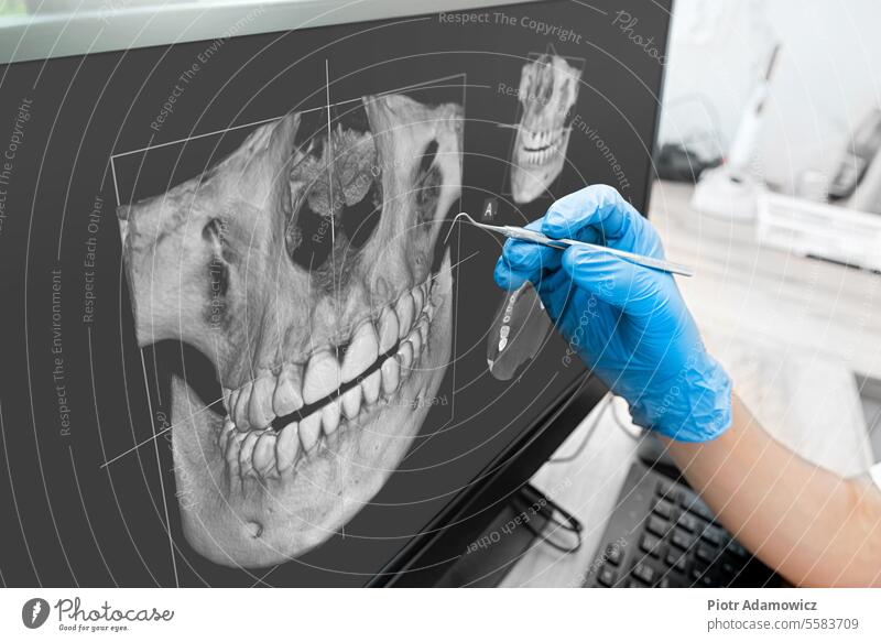 Doctor pointing teeth x-ray on computer monitor dental xray dentist panoramic jaw screen bone mouth radiology clinic image head healthy human oral anatomy