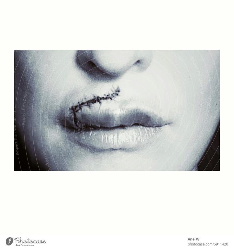 the scar - black and white image of a female face with a freshly stitched scar above the lip Scar Accident Face Parts of the face Close-up Mouth Lips Wound