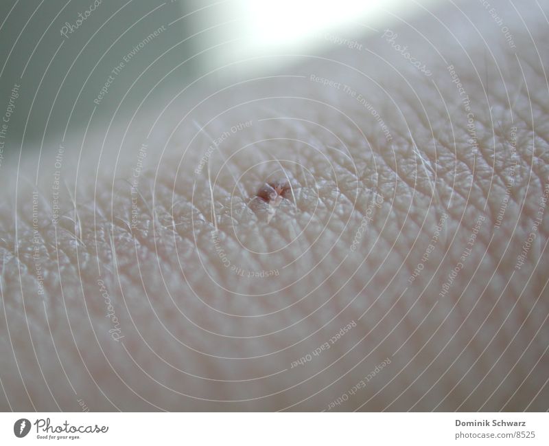 Dot Mole Macro (Extreme close-up) Human being Skin Detail Hair and hairstyles melanoma Pigmented mole