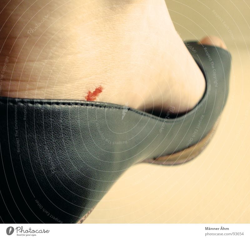 women's complaint Woman Footwear Leather Blood Leather shoes Abrasion Wound Sharp pain Black Bubble Landing Feet Pain Skin Close-up
